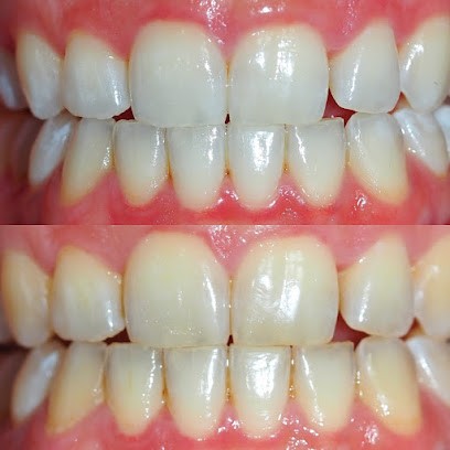 Docteur Nathalie Atlan, Dentiste à Saint-Maur-des-Fossés