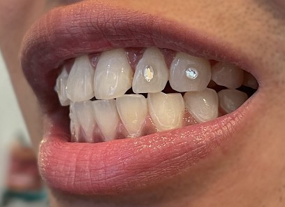 Sorry Daddy Gems, Dentiste à Nice