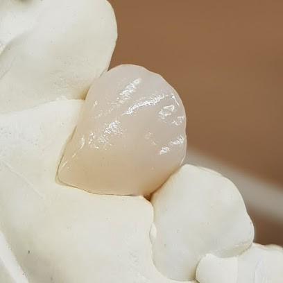 Prothésiste dentaire à Paris, Dentiste à Paris 12