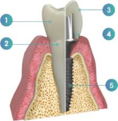 Docteur THAM LAMIA , cabinet dentaire de l Europe, Dentiste à Rillieux-la-Pape