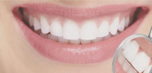 Dr Isabelle BUNISSET, Dentiste à Toulouges