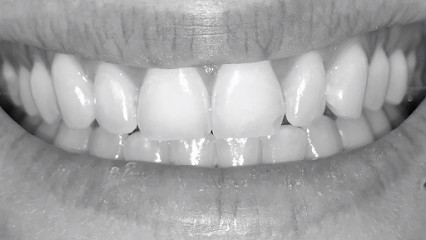 Cabinet Liberté - Docteur Arnaud Desrumaux, Dentiste à Saint-Chamond