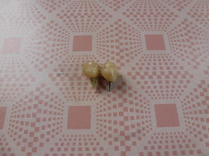 Docteur Fregnacq Olivier, Dentiste à Neuville-sur-Saône