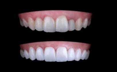 Cabinet dentaire de l'Hautil, Dr FISCHER, Dr BLAJMAN, Dr ABEN DANAN, Dr WASSERLAUF, Dr SOUSSAN, Dr AMANOU, Dentiste à Carrières-sous-Poissy