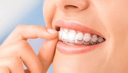 Docteur Christophe Haus, exercice exclusif en orthodontie, Dentiste à Oberhausbergen