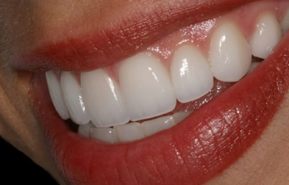 Docteur Carabelli Célia Chirurgien-Dentiste Dentiste à Belley