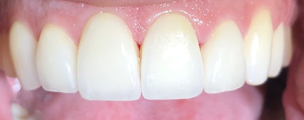 Dr Georgel Camille Dentiste Montpellier - Implantologue et parodontiste - implant dentaire - parodontie - esthétique, Dentiste à Montpellier