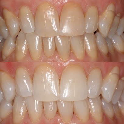 Dr Dental Pignoly Nicolas, Dentiste à Marseille 12