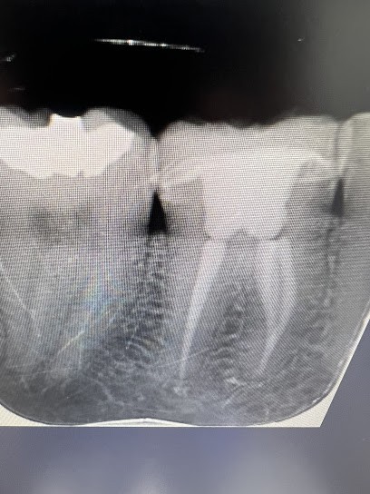 Dr Edouard COCQUEMPOT, Dentiste à Mametz