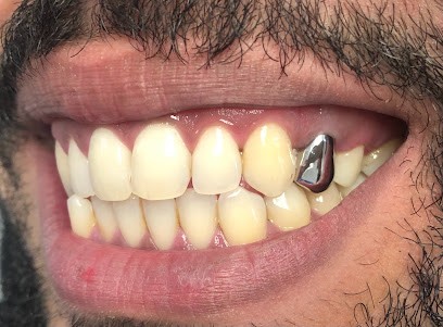 Dominique Elbaz - Dentiste, Dentiste à Paris 11