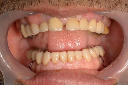 Klifa Philippe, Dentiste à Montreuil