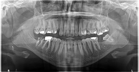 Cabinet Dentaire Des Mathurins, Dentiste à Paris 09