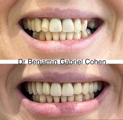 Dr Benjamin COHEN - Facettes dentaires - Blanchiment dentaire - Dentiste Esthétique, Dentiste à Paris 16