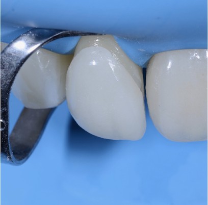 Docteur Romain RUITORT Esthétique Dentaire, Dentiste à Nice