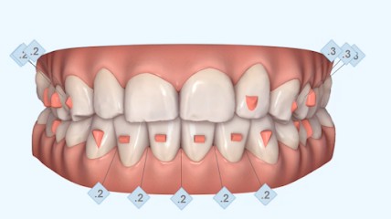Dr Marta Gracia (RDV En Ligne Possible), Dentiste à Ploemeur