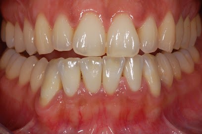 Dr BISSON Bertrand - Dentiste - Metz, Dentiste à Metz