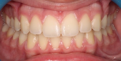 DR GUILLERMIN Anthony Louis - Orthodontie - Pratique réservée à l'orthodontie, Dentiste à Mantes-la-Jolie